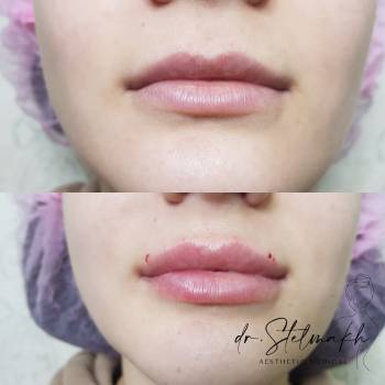 Фото с портфолио Екатерина Стельмах