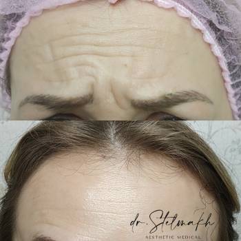 Фото с портфолио Екатерина Стельмах