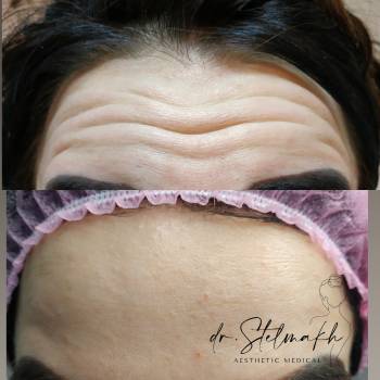 Фото с портфолио Екатерина Стельмах