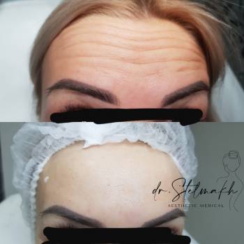 Фото с портфолио Екатерина Стельмах