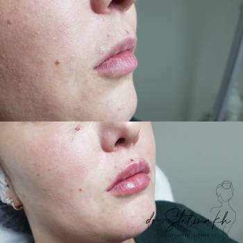 Фото с портфолио Екатерина Стельмах