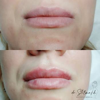 Фото с портфолио Екатерина Стельмах