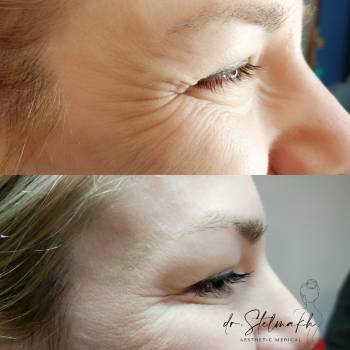 Фото с портфолио Екатерина Стельмах