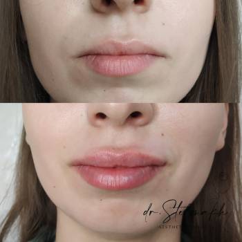 Фото с портфолио Екатерина Стельмах