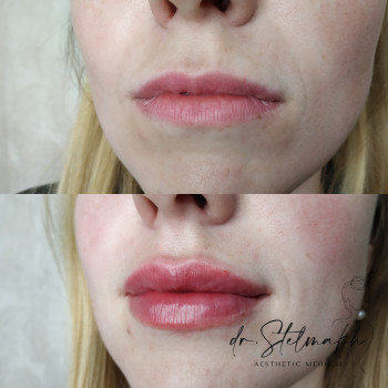 Фото с портфолио Екатерина Стельмах