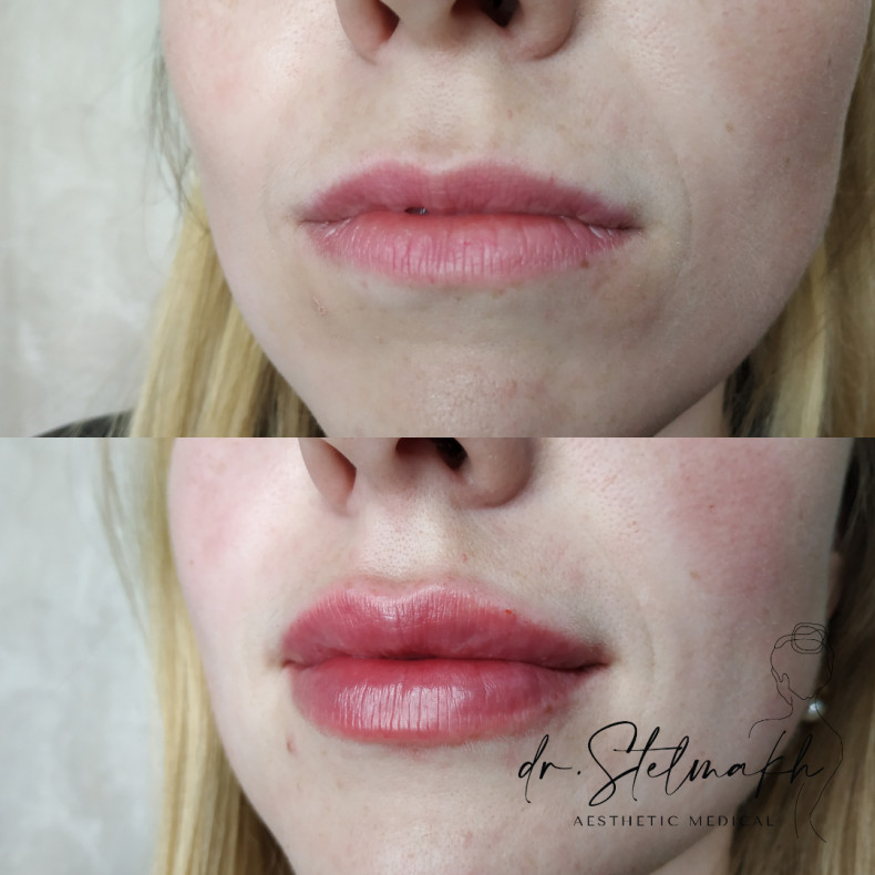 Фото с портфолио Екатерина Стельмах