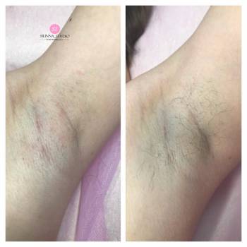 SILINNA, Полтава Фото - 7