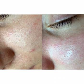 Валерия Бобух, Полтава Фото - 29