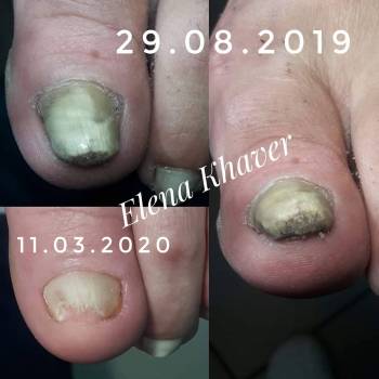 Елена Олеговна Хавер, Черкассы Фото - 12