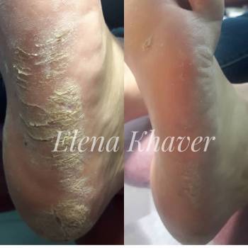 Елена Олеговна Хавер, Черкассы Фото - 13