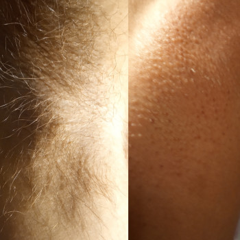 Фото из портфолио мастера Надежда (мастер депиляции, Николаев)