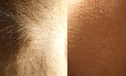 Депиляция Мастер депиляции Надежда Николаев