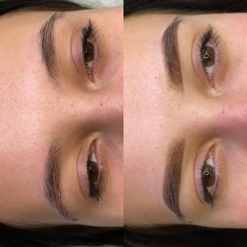 Пудровые брови
                    Косметолог Анна Вінниця