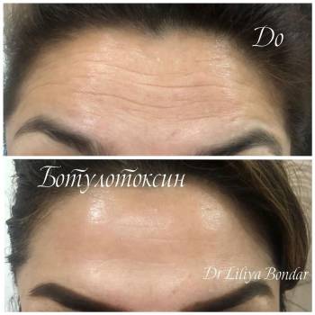 Фото с портфолио Лилия Бондарь