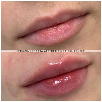 Центр естетичної медицини Оксани Короткої, Луцк Фото - 9