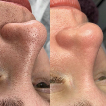 Фото с портфолио Екатерина Дмитриева