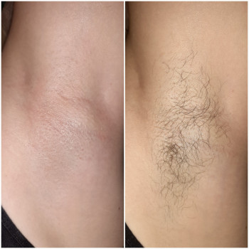 Фото из портфолио мастера Марина (мастер депиляции, Одесса)