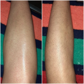 Фото из портфолио мастера Марина (мастер депиляции, Одесса)