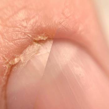 Комбинированный маникюр "До/После", фото -  Pomaranch studio