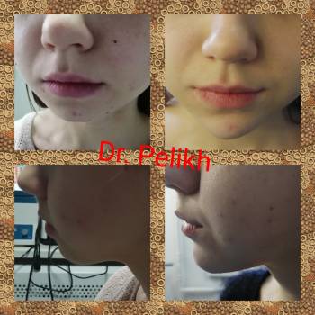 Beauty clinic Dr.Pelikh, Хмельницький Фото - 27