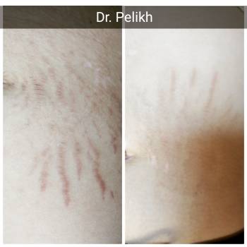 Beauty clinic Dr.Pelikh, Хмельницький Фото - 29