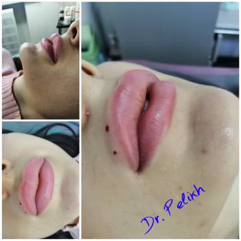 Beauty clinic Dr.Pelikh, Хмельницький Фото - 30