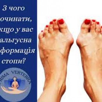 Деформация на обеих ногах. Здесь причина совсем не там где е