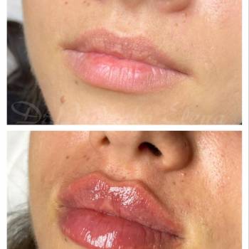 Елена Пойденко, Харьков Фото - 5