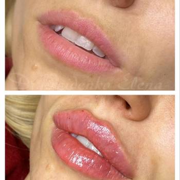 Елена Пойденко, Харьков Фото - 6