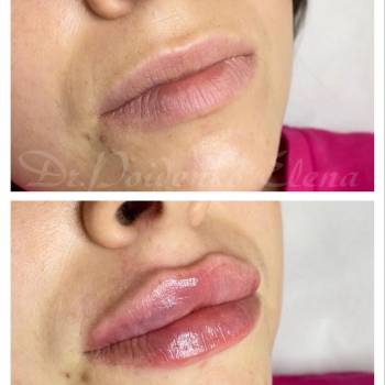 Елена Пойденко, Харьков Фото - 10