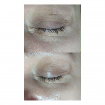 Eye Perfection уход, CASMARA
                    Косметолог-естетист Ирина Київ