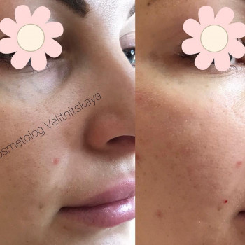 Марина Велитницкая, Кропивницкий Фото - 8