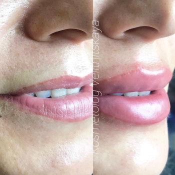 Марина Велитницкая, Кропивницкий Фото - 7