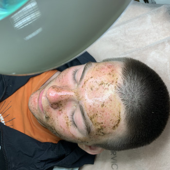 Пілінг після гігієнічної чистки