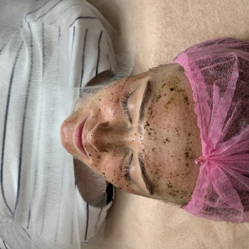 Рослинний пілінг