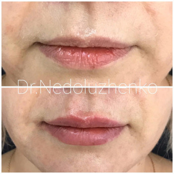 Ксенія Недолуженко, Ужгород Фото - 37