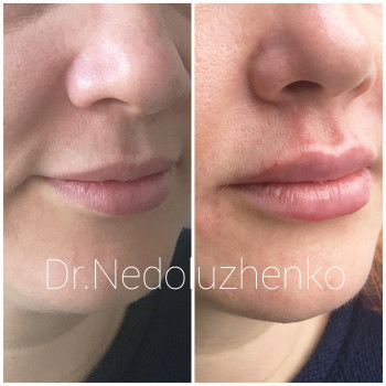 Ксенія Недолуженко, Ужгород Фото - 39