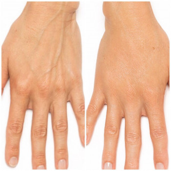 Ксенія Недолуженко, Ужгород Фото - 42