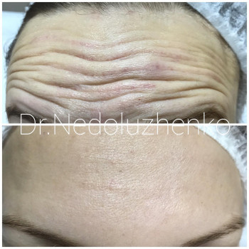 Ксенія Недолуженко, Ужгород Фото - 41