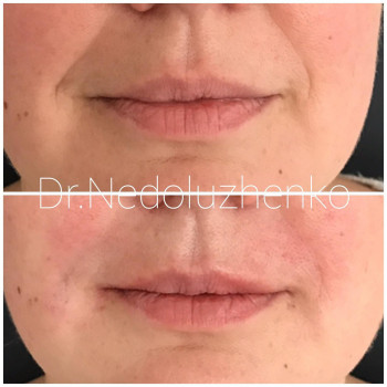 Ксенія Недолуженко, Ужгород Фото - 35