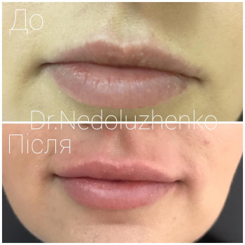 Ксенія Недолуженко, Ужгород Фото - 44