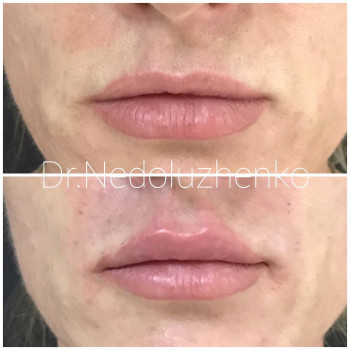 Ксенія Недолуженко, Ужгород Фото - 45