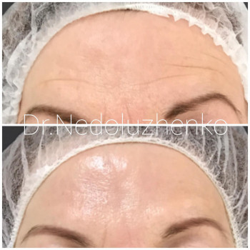 Ксенія Недолуженко, Ужгород Фото - 46