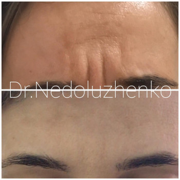 Ксенія Недолуженко, Ужгород Фото - 47