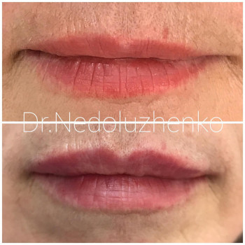 Ксенія Недолуженко, Ужгород Фото - 48