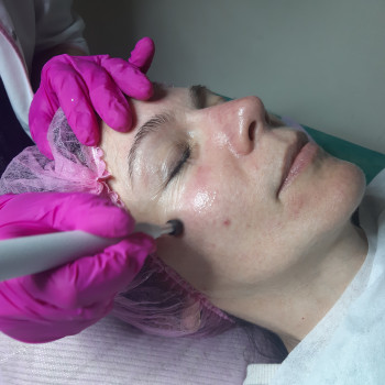 Чистка лица комбинированная 