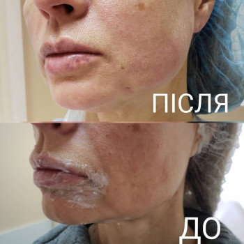 Софія Голуб, Івано-Франківськ Фото - 38