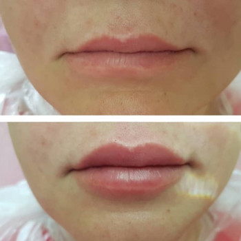 Софія Голуб, Івано-Франківськ Фото - 40