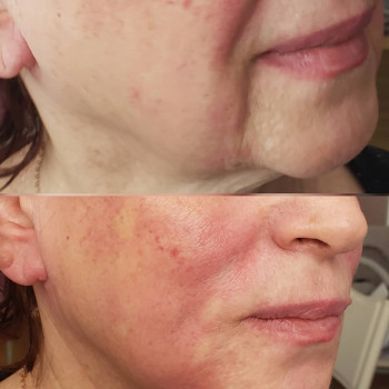 Софія Голуб, Івано-Франківськ Фото - 9