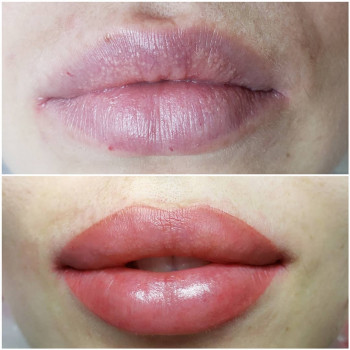 Софія Голуб, Івано-Франківськ Фото - 12